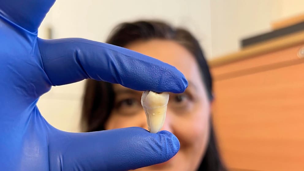 Forscher haben eine Möglichkeit entwickelt, Zähne aus den eigenen Zellen des Patienten zu entwickeln.