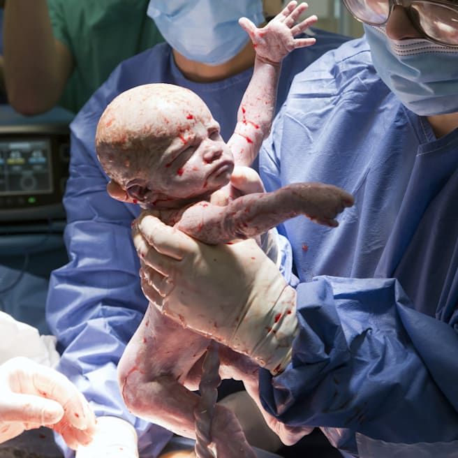 Transplantations-Wunder: Britin schenkt Schwester Gebärmutter – Baby Amy da!