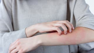 Juckreiz: Ursache, Diagnose und Behandlung