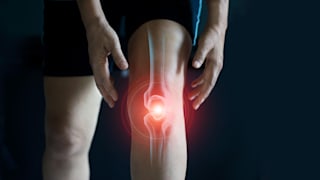 Arthrose: Ursachen, Symptome, Behandlung
