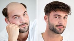 Teaser-Bild