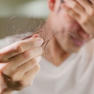 Cola und Energy sorgen bei Männern für Haarausfall