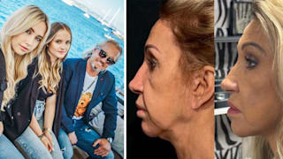Carmen Geiss’ Facelifting: Wie ihre Familie ihr neues Gesicht findet