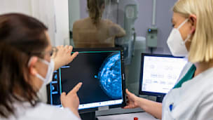 Entscheidung Mammografie: Expertin enthüllt Wahrheit für Frauen ab 50