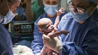 Transplantations-Wunder: Britin schenkt Schwester Gebärmutter – Baby Amy da!