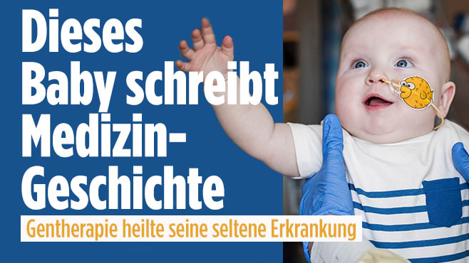 Baby erhält lebensrettende Gentherapie und weckt Hoffnungen weltweit