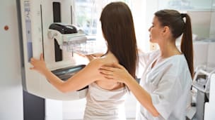 Mammografie-Debatte: Expertin empfiehlt Screening ab 50