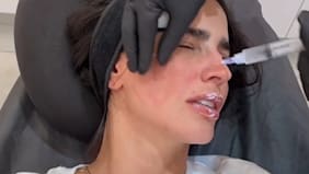 Kim Kardashian hat es vorgemacht: Lachs-Sperma soll schön machen