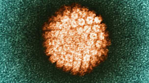 Expterin gibt Infos: Wie HPV Krebs auslösen kann