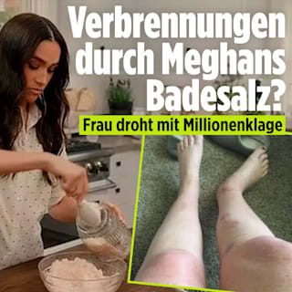 Meghan droht Millionenklage: Verbrennungen durch ihr Badesalz?