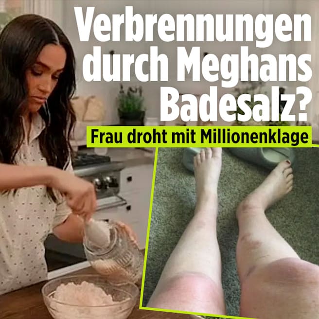 Meghan droht Millionenklage: Verbrennungen durch ihr Badesalz?