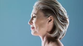 Das passiert in Ihrem Gesicht, wenn Sie altern