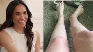 Meghan droht Millionenklage: Verbrennungen durch ihr Badesalz?