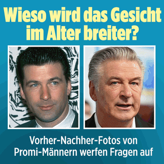  Werden Männer-Gesichter im Alter breiter?