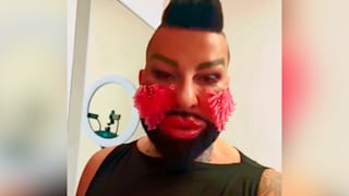 Modeguru schmerzbefreit: Glööckler im Nadel-Wahn