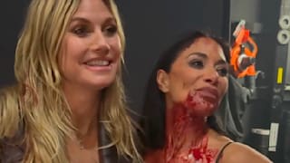Fototermin am Broadway: Hat Heidi Nicole gebissen?