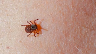  FSME durch Zecken: Symptome, Behandlung und Vorbeugung 
